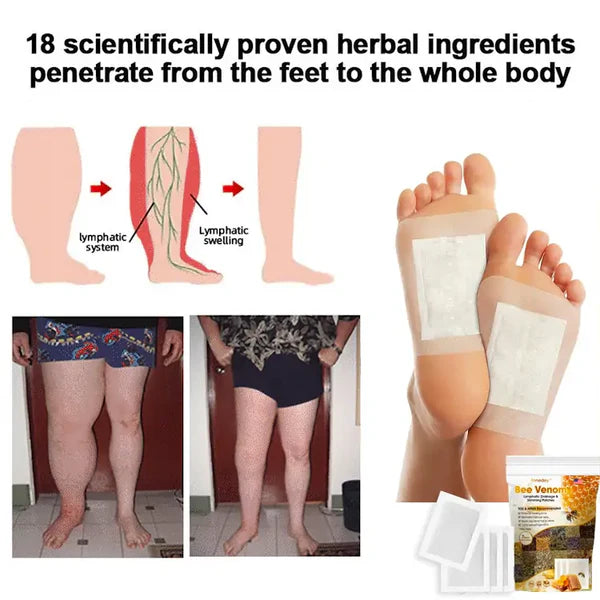 Bee Venom Lymphatic Drainage & Slimming Foot Patches 🌿👣 (BUY 1 GET 1 FREE)